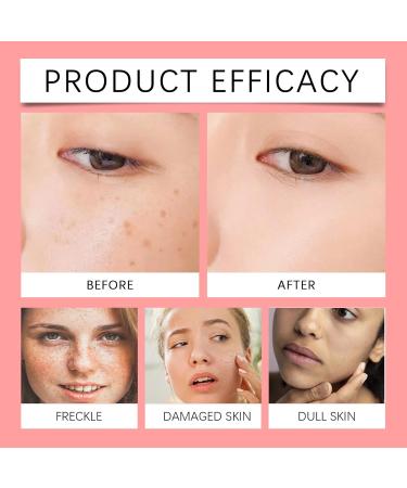 Aobenz Whitening and Freckle Removing Essence Aobenz Anti-Spot Cream Aobenz Niacinamide Serum Anti Wrinkle Aging Face Lift Tighten Reduce Finelines Moisturing Essence (1) - Buy Online on GoSupps.com