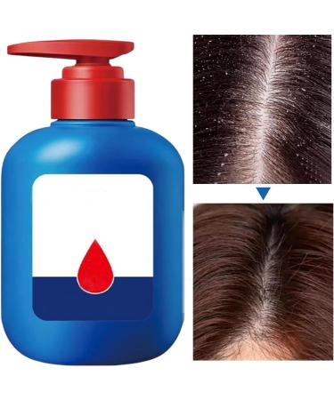 G n rique Oil Control Volumizing Shampoo Deep Cleansing Refreshing Hair Wash Strengthening Anti-Hair Loss Care Weight 300ml Nourishing Formula for Men and Women Natural - Buy Online on GoSupps.com