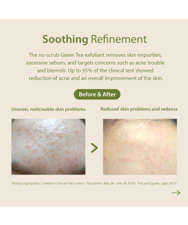 Blith Defined Spray Mask - Soothing Green Tea & Lactic Acid Face Peeling for Acne-Prone Skin (150ml) - Gentle Exfoliation & Healing - Buy Online on GoSupps.com