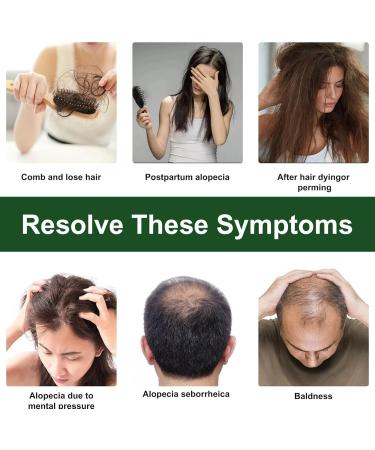 Sysdisen Rosemary Oil | 60 ML Hair Growth Oil | Natural Anti Hair Loss Nourishes Scalp for Dry and Damaged Hair and Growth Oil - Buy Online on GoSupps.com