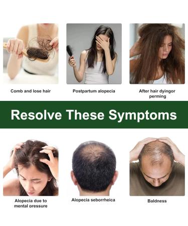 Rosemary Hair Oil 60ml - Natural Bio Anti-Hair Loss Solution Nourishes Scalp Stimulates Growth & Improves Circulation | Joyivike - Buy Online on GoSupps.com