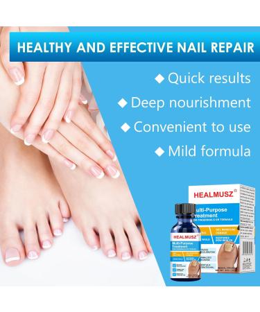 Yagaspantery 30 ml toenails caring nail repair protection and strengthening of brittle nails moisturizes dry nail skin for beautiful and wellgroomed nails nail growth and repair serum white - Buy Online on GoSupps.com