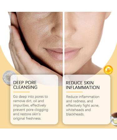 KLYso Gentle Hydrating Facial Cleanser - Deep Pore Cleansing Oil Control Moisturizing & Skin Repairing Face Wash For Acne Blackhead & Whitehead Treatment(2PCS) - Buy Online on GoSupps.com