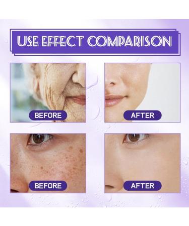 B3 Vitamin B3 Serum Dark Spot Corrector Niacinamide Serum - Dark Spot Corrector Anti-Aging Face Serum + Niacinamide Long Lasting Results (1PC) - Buy Online on GoSupps.com