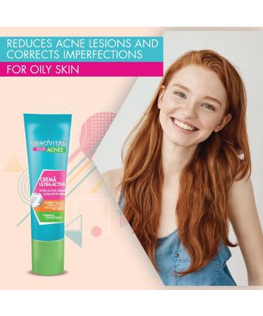 Ultra-Active Face Cream for Acne with Salicylic Acid Reduces Sebum Excess and Pimples Corrects Skin Imperfections Concentrated Formula 15 ml Gerovital Stop Acnee - Buy Online on GoSupps.com