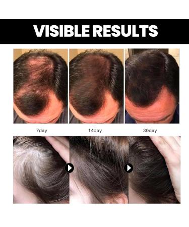 Batana Oil for Hair Growth - 100% Pure Natural Oil from Honduras | Prevent Hair Loss & Split Ends | Nourishes Hair & Skin for All Types - Buy Online on GoSupps.com