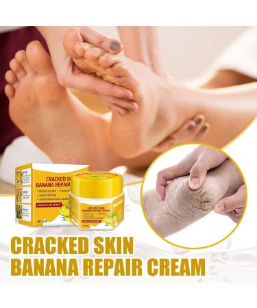  smashing smashing Chapped Feet Repair Cream | Banana Foot Repair Skin Healing Moisturizing 30g Chapped Heel Moisturizer Foot Repair for Removing Dead Skin - Buy Online on GoSupps.com