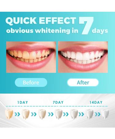 28 Bandes Blanchiment Dentaire blanchiment des dents sans peroxyde Sans Sensibilit Strips pour blanchiment des dents rapide et doux limine les taches profondes R sultats Visibles Rapidement Bleu - Buy Online on GoSupps.com