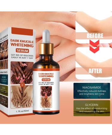 KOAHDE Hand Knuckle Whitening Serums Knuckle Skin Lightening Serums Dark Knuckle Whitening Serums Dark Knuckle Corrector Serums Removing Dark Spots Essence Acanthosis Nigricans Whitening Oil 50ML - Buy Online on GoSupps.com