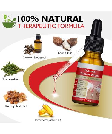 Natural Ingrown Toenail Treatment & Pain Relief Drops - 30ml (1 bottle) - Buy Online on GoSupps.com