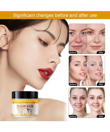 Wenrny Beef Tallow and Honey Balm for Skin 2 Oz Beef Tallow Balm for Skin Hydration Grass Fed Beef Tallow Full Body & Face Moisturizer Tallow Honey Moisturizer All Natural Body Moisturizing Cream - Buy Online on GoSupps.com