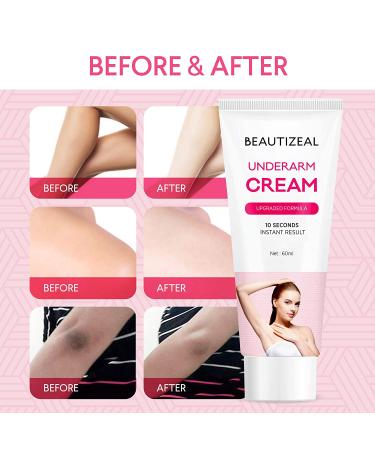 â€œDark Spot Corrector Cream for Armpits, Knees, Elbows & Private Areas - Instant Resultsâ€‌ - Buy Online on GoSupps.com