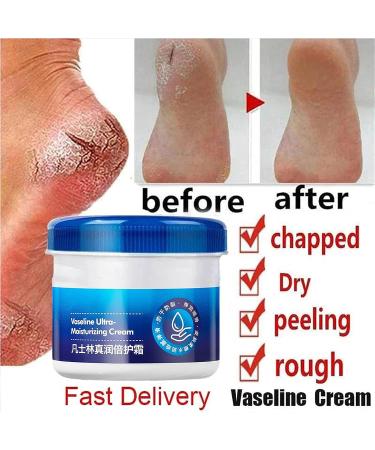 Genryu Anti-Cracking Foot Cream - Intensive Repair for Cracked Heels - 2PCS Set - Buy Online on GoSupps.com
