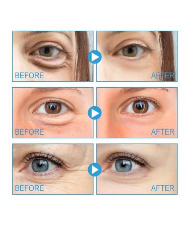 Caffeine Eye Cream for Dark Circles & Puffiness | Anti-Aging Treatment for Fine Lines & Bags (2PCs) - Shop Now! - Buy Online on GoSupps.com