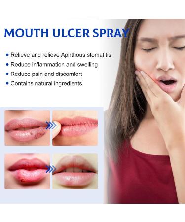 Spray de Soulagement Ulc res Spray Ulc res de la Bouche Spray De Soins Bucco-Dentaires Sprays de Soulagement des Maux de Dents Spray Contre les Aphtes Spray de Soulagement Ulc res Buccaux - Buy Online on GoSupps.com