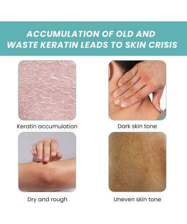 Buy Skin So Soft Original Bath Oil 3.4 fl. oz - Moisturizing & Softening for Women | Pack of 2 - International Shipping Available - Buy Online on GoSupps.com