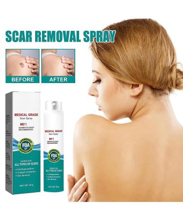South Moon Medical Grade Scar Spray - Advanced Scar Removal Treatment for All Types of Scars - Acne & Dark Spot Remover - Gentle & Non-Irritating (2Pcs) - Buy Online on GoSupps.com