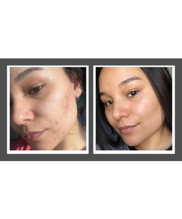 CIRCCELL Wooshie S Blend - Best Face Oil for Oily & Problematic Skin | International Shipping Available - Buy Online on GoSupps.com