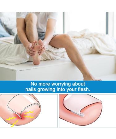 Ingrown Toenails Set Toenail Correction Patch Nail Clip Toenails Ingrown Toenails Toenail Correction with Lifter for Ingrown Toenails 40 Pieces - Buy Online on GoSupps.com