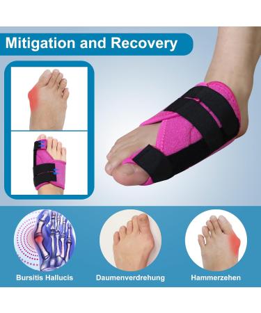 Hallux Valgus Correction Rail - Relief for Large Toe Pain Align Toes Big Toe Protection for Men & Women (Rose Red Left) - Buy Online on GoSupps.com