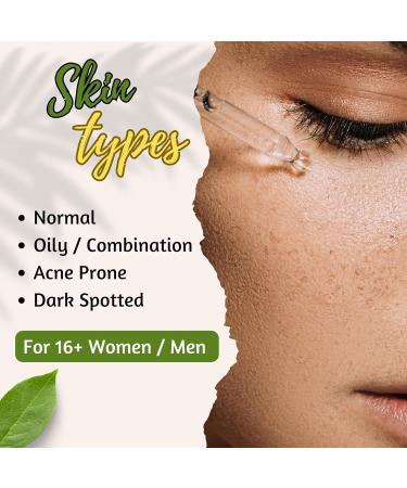 Fri'lla Niacinamide 10% + Zinc PCA Serum - Minimize Pores Control Oil Hydrate - Achieve Clear Smooth Skin with Radiant Glow | 30ml (Pack of 1) - Buy Online on GoSupps.com