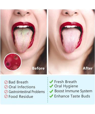 4-Piece Copper & Stainless Steel Tongue Cleaner Set | Effective Tongue Scraper & Brush for Oral Hygiene - Buy Online on GoSupps.com