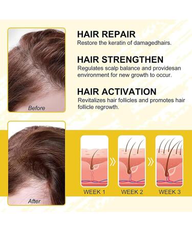 Castor Oil for Hair Growth Organic Castor Oil for Hair Growth Eyelashes and Eyebrows Natural Hair Density Essential Oil Hair Growth Serum for Hair Rapid Growth and Thickening - Buy Online on GoSupps.com