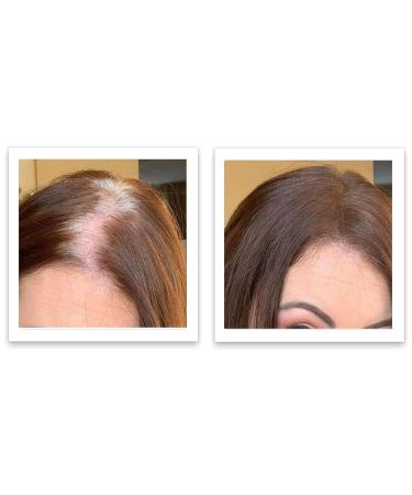 Caboki 10X Volumizing Hair Powder - Talc-Free Dark Gray | Root Touch Up for Thinning Hair | Cover Bald Spots for Men & Women - Buy Online on GoSupps.com