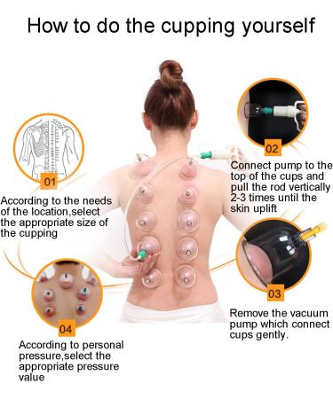 AIKOTOO 32 Cups Cupping Set with Pump | Hijama Cupping Therapy Kit for Acupoint Massage | Professional Chinese Vacuum Suction Cups for Pain Relief and Cellulite Massage - Buy Online on GoSupps.com