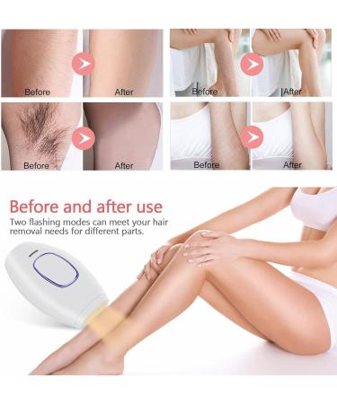 IPL Beauty Device for Permanent Hair Removal | Pain-Free Whole Body Laser Hair Removal for Men & Women - Buy Online on GoSupps.com