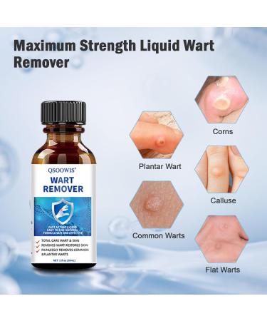 QSOOWIS Wart Remover Skin Tag Remover for Warts Plantar Wart - 1 Fl Oz - Buy Online on GoSupps.com