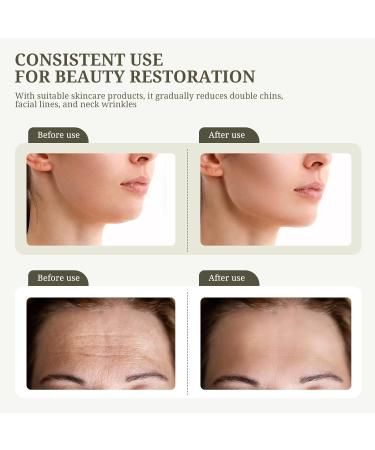 Pelcas 4-in-1 Face Massage Device - Anti-Wrinkle EMS Beauty Tool with Heat LED & Vibration for Skin Tightening & Lifting | USB Rechargeable - Buy Online on GoSupps.com