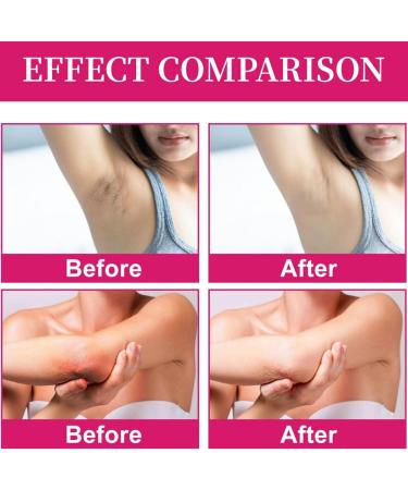 Kojic Acid Skin Underarm Cream Korean Skin Care for Women Kojic Acid Skin Cream Dark Neck Remover Cream Kojic Acid Knee Cream Cream Kojic Acid Collagen Cream For Dark Underarm Underarm Skin Cream - Buy Online on GoSupps.com