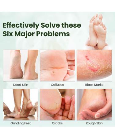 Tea Tree Foot Peel Mask - Exfoliating Treatment for Callused and Cracked Heels - 2 Pack - Buy Online on GoSupps.com