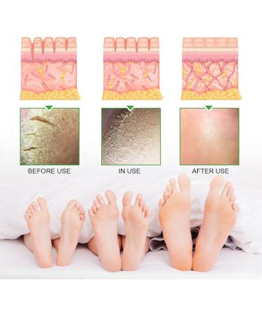 COALHO Heel Repair & Hydration Cream Rapid Crack Repair Foot Cream Anticracking Moisturizing Foot and Hand Cream Provides Comfortable Care 3 pieces - Buy Online on GoSupps.com