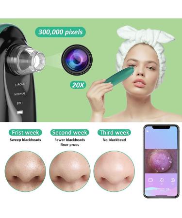 Blackhead Remover Pore Vacuum with Camera - Rechargeable Blackhead Suction Tool for Face and Nose - Skin Acne Pimple Cleaner for Men and Women - Buy Online on GoSupps.com