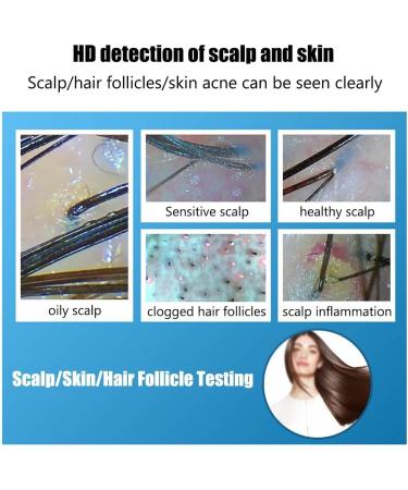 SDTOOP Skin and Hair Analyzer 4-Spectrum Scalp Hair Detector Hair Follicle Detection + Skin Detection 50 and 200 Lens 10 Million Pixels - Buy Online on GoSupps.com