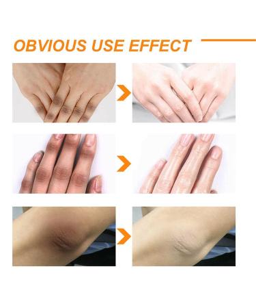 Buy 100ml Body Whitening Cream & Peeling Lotion | Skin Lightening & Brightening Gel | Orange Peeling Cream for Dark Skin | Improve Your Body Skin (2PCs) - Buy Online on GoSupps.com