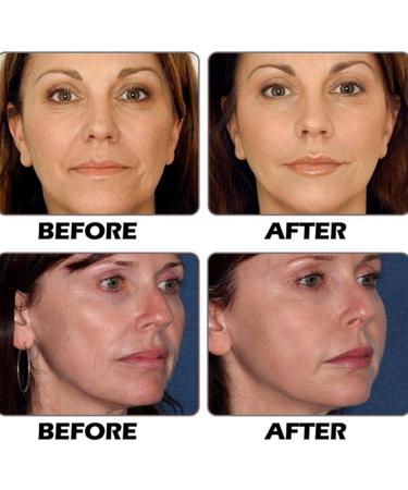 Dragon Blood Easy Cream Retinol Placenta Dragon Blood Cream Dragon Blood Anti Aging & Wrinkle Face Cream Dragons Blood Serum Face Moisturizer for Women Retinol Face Cream for Hydrating & Moisturising - Buy Online on GoSupps.com