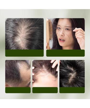 WJnflQN Shampoo Bar Natural Solid Shampoo for Dry Hair Shine Restoration Oat Care for Thick Curly Damaged Hair Women Men Daily Sports Travel - Buy Online on GoSupps.com