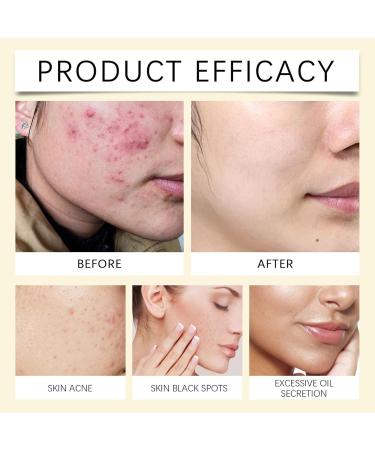 Turmeric Kojic Cleansing Pads | Turmeric Exfoliate Pads For Face | 40 Turmeric Kojic Cleansing Pads | Exfoliation Pads For Cleansing And Exfoliation - Buy Online on GoSupps.com