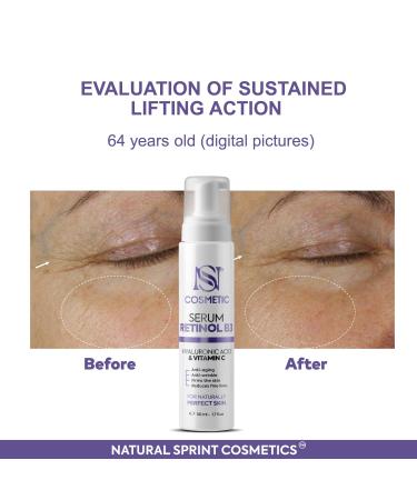 Anti Aging Face Serum with Retinol Vitamin C Vitamin B3 & Hyaluronic Acid Deep Hydration Collagen Boost Wrinkle Reduction & Skin Firming Lightweight Formula 50 ml - Buy Online on GoSupps.com