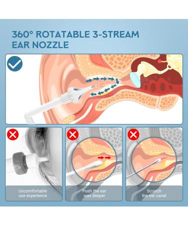 USB-Rechargeable Ear Irrigation Flushing System - 5 Modes Waterproof Ear Cleaner for Effective Earwax Removal | Ideal for Adults & Kids - Buy Online on GoSupps.com