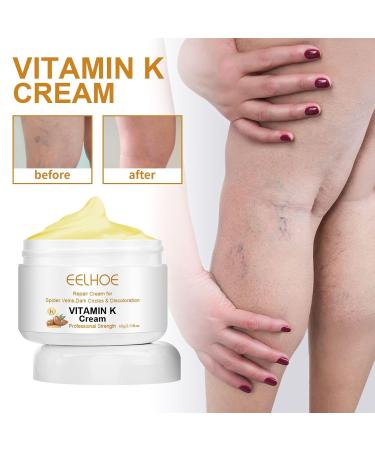 2PCS Varicose Veins Miracle Cream - Vitamin K Formula for Legs & Face | Deeply Nourishing & Moisturizing | All Skin Types - Buy Online on GoSupps.com