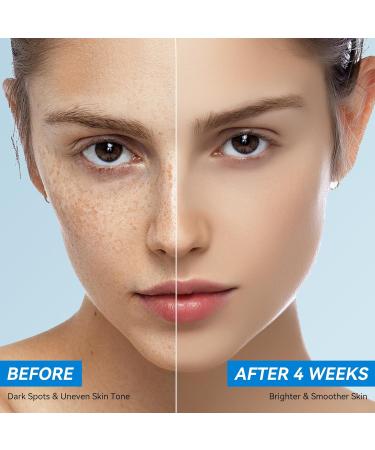Dark Spot Remover Face and Body, Dark Spot Corrector Cream for Age Spot Sun Spot Melasma Freckles, Rapid Corrects Uneven Skin Tone, with Hyaluronic Acid and Retinol for Women and Men 1.7 Fl Oz (Pack of 1) - Buy Online on GoSupps.com