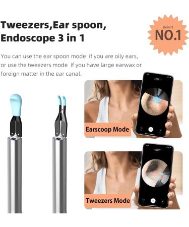 Wireless Ear Wax Removal Kit with 1920P FHD WiFi Camera | Ear Cleaner for Adults, Kids, Pets | Visual Otoscope Endoscope for iOS Android | Includes Ear Pick & Tweezers - White - Buy Online on GoSupps.com