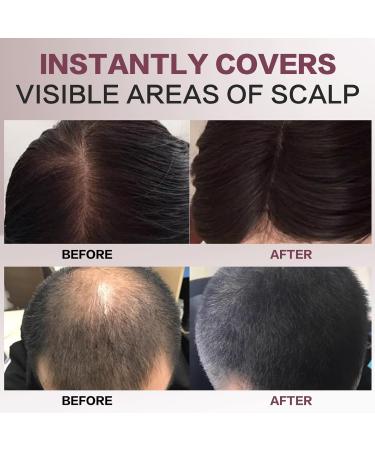 Hairline Powder Hairline Shadow Quick Cover Hair Root Concealer Eyebrows & Beard Line for Thinning Hairline Windproof&Sweatproof for Men and Women. (Medium Brown) - Buy Online on GoSupps.com