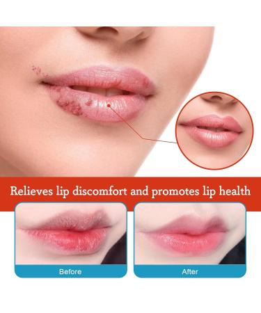 Healing Lip Balm for Dry Cracked Lips | Natural & Organic Cheilitis Treatment for Men Women & Children | Dermatologist Recommended All-Day Moisture - Buy Online on GoSupps.com