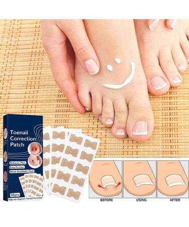 Toenail Correction Patch 100PCS - Professional Ingrown Toenail Corrector Strips for Foot Care - Health Toenail Treatment Tool for Glue-Free Nail Correction - Blue - Buy Online on GoSupps.com