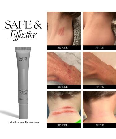 Doctor Rogers Restore Restore Healing Balm - 0.5 Oz. - Buy Online on GoSupps.com